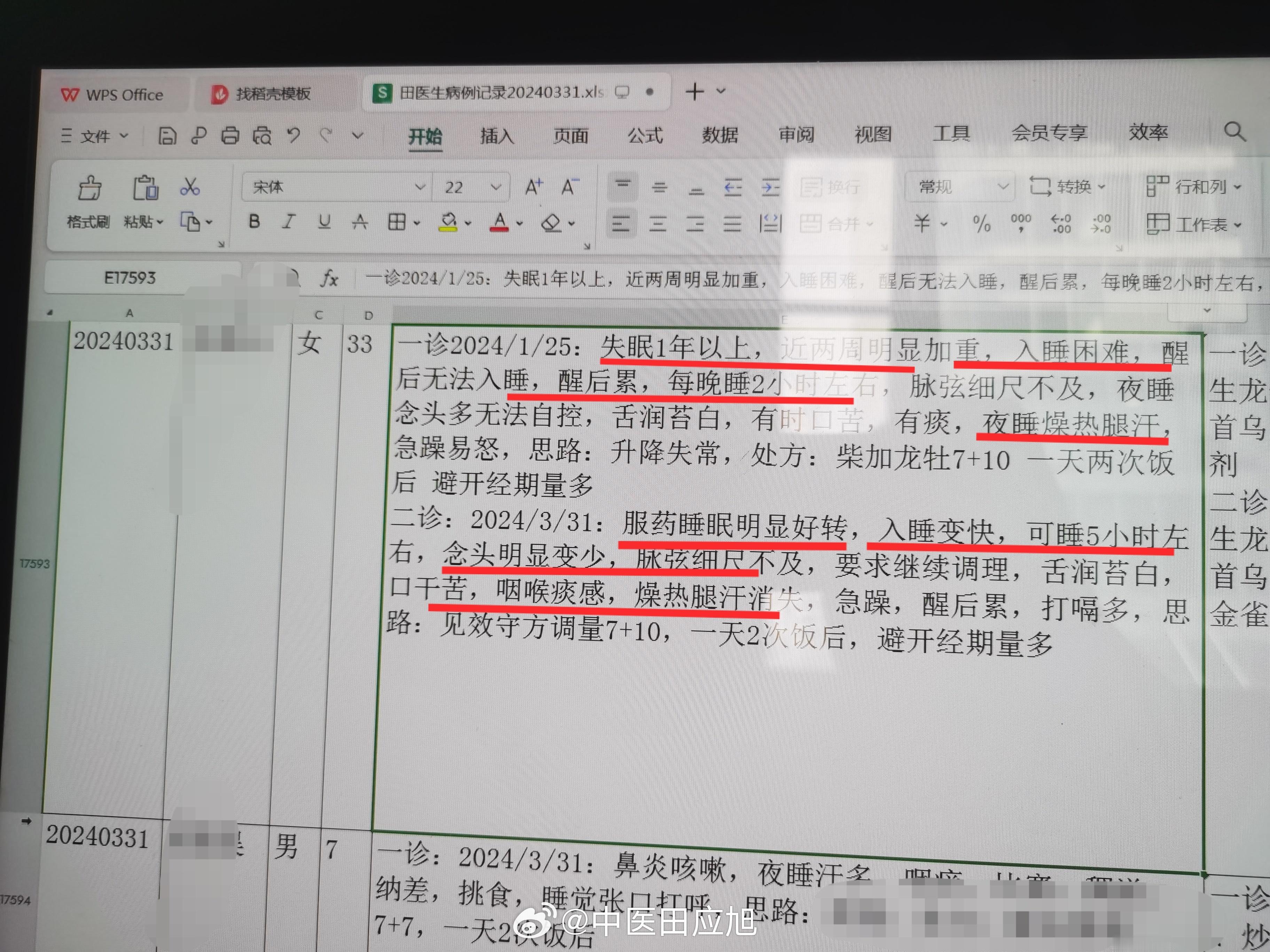 #中医##失眠#  女  33岁，失眠一年加重2周，入睡非常困难，每晚睡2小时，