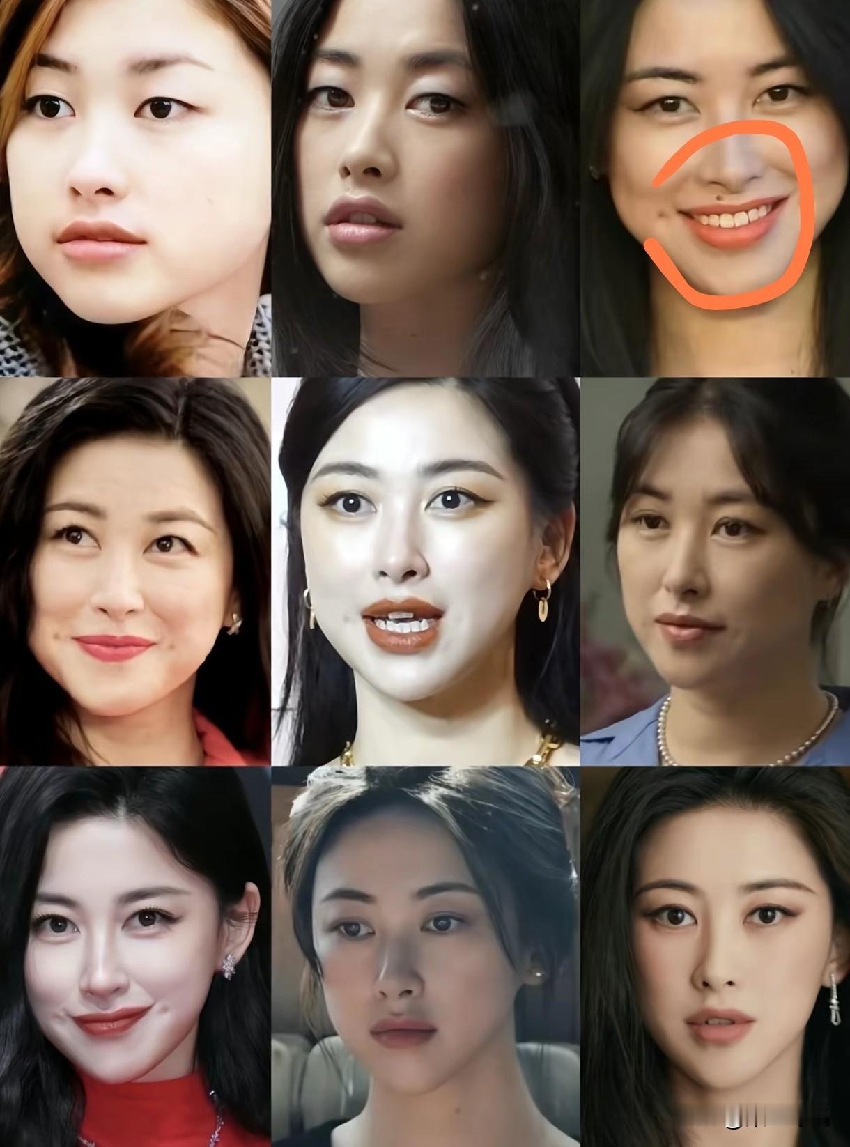 真的不用担心，
朱珠的“富贵痣”点掉了，
结果并不是大家想的那样，
我也有一个亲