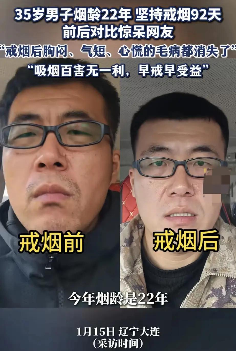 辽宁大连的谢先生今年35岁，抽烟抽了22年。最近他坚持戒烟92天，把自己前后的状