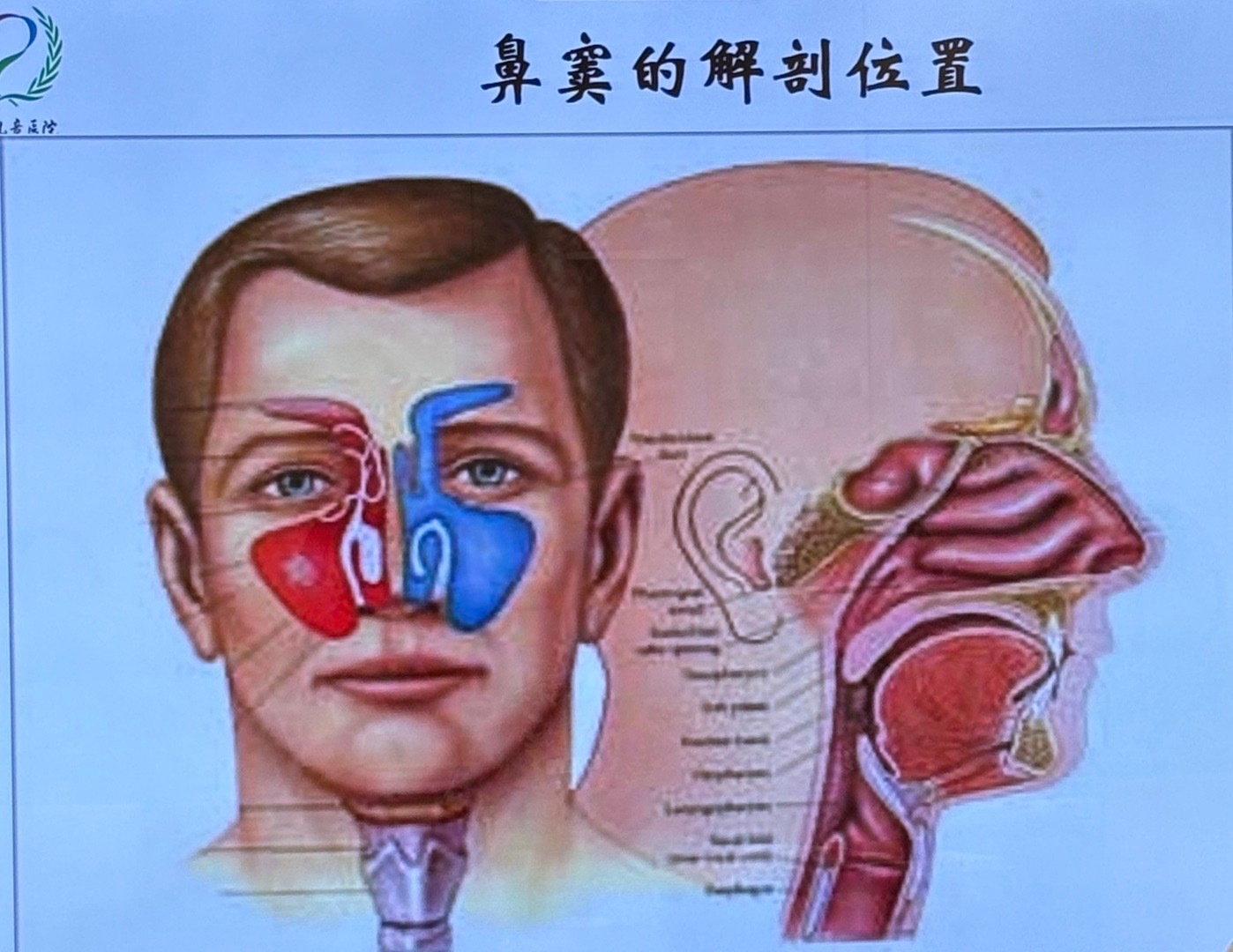 很多过敏的孩子都有鼻炎！鼻炎的大人和孩子得病的现在特别多，跟季节和环境密切相关，