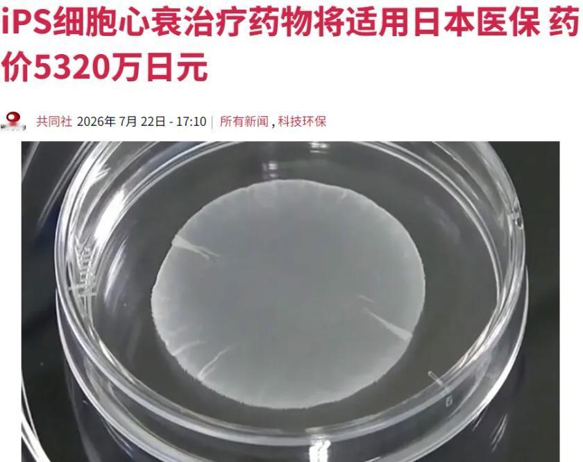 日本又放大招了：一款叫 RiHEART（リハート） 的 iPS 心肌细胞片，20