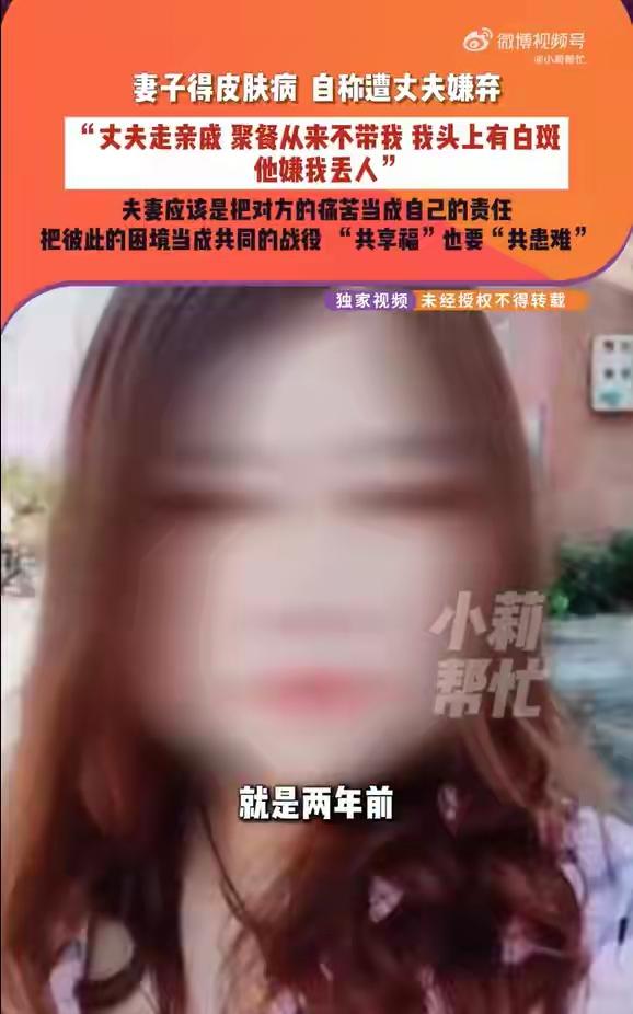 白癜风并非“丢人”的标签，背后隐藏的是社会偏见与家庭困境

2026年1月10日