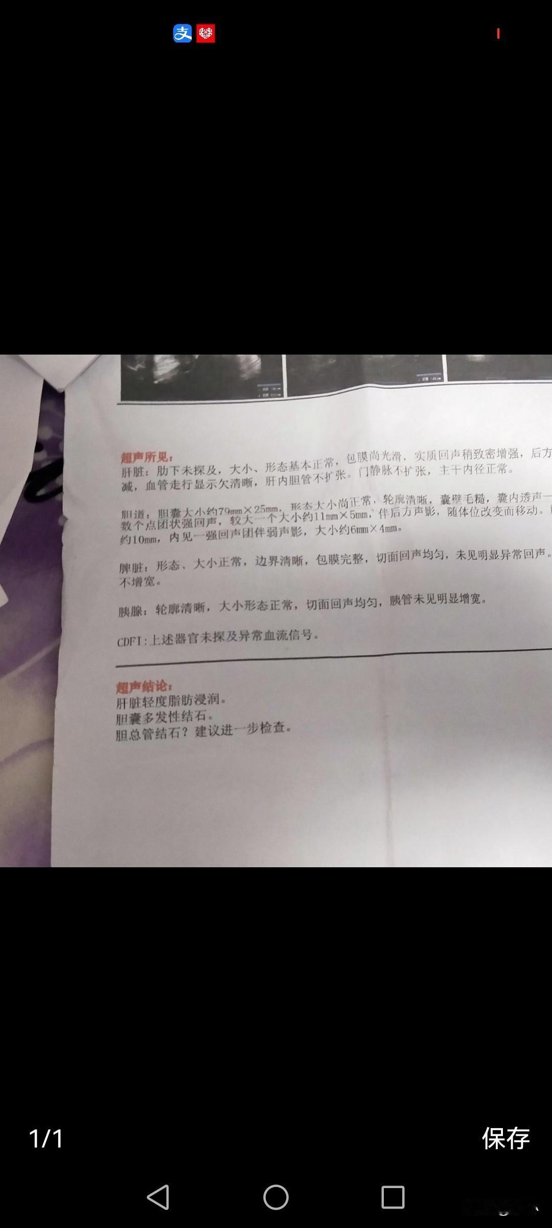 很多人都说胆结石排不出来，我也相信排不出来，胆管太小，石头比小，怎么排？
 
胆