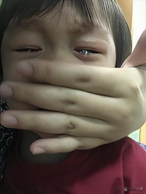 村里有个男孩因调皮打架，被父亲一巴掌扇成斜视。
这家人当时没及时医治，孩子的眼睛