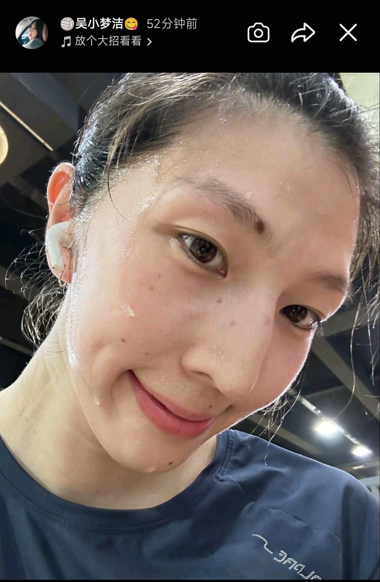 吴梦洁已经开始恢复训练啦！中国女排2026世界女排联赛