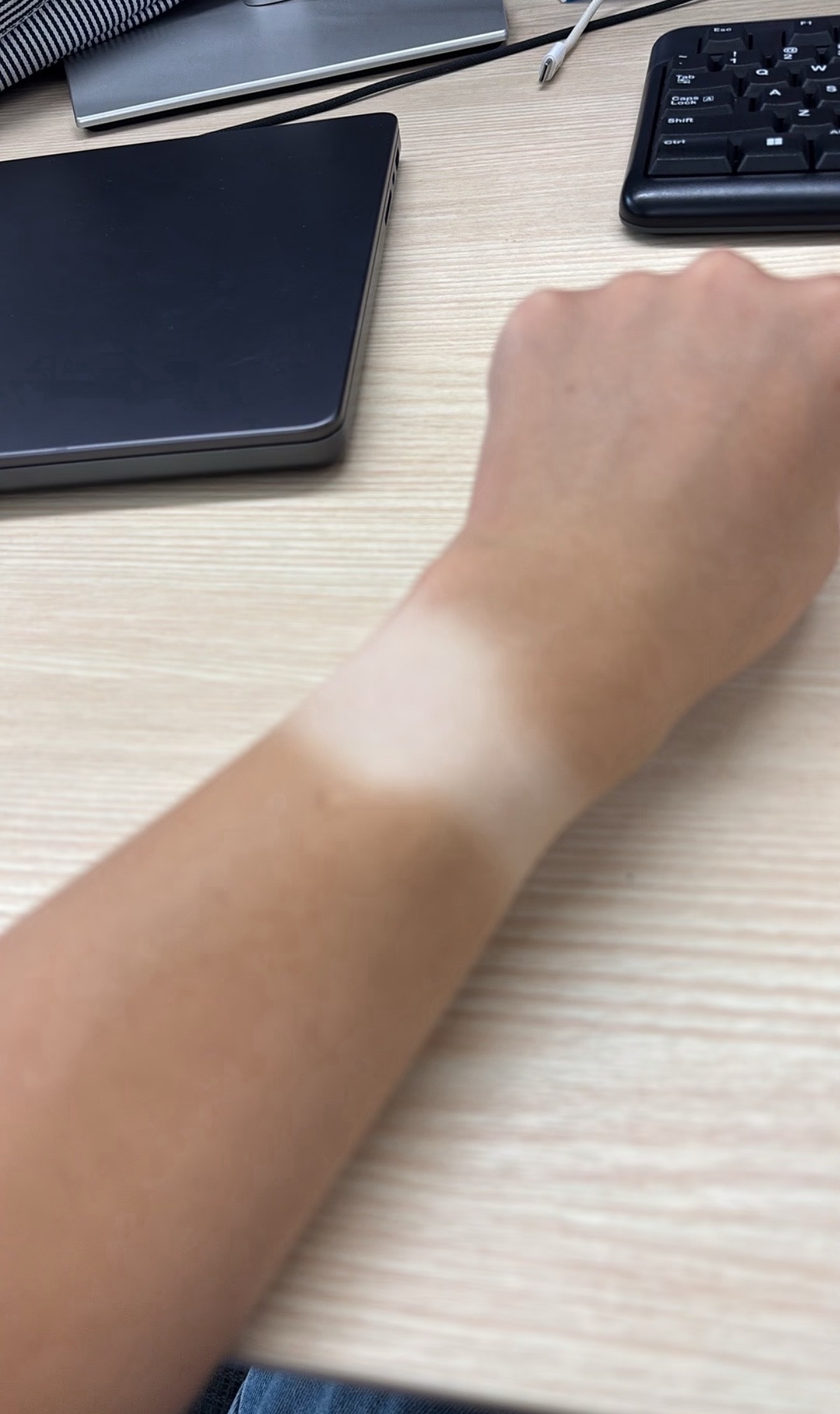 晒成这样还能白回来吗 