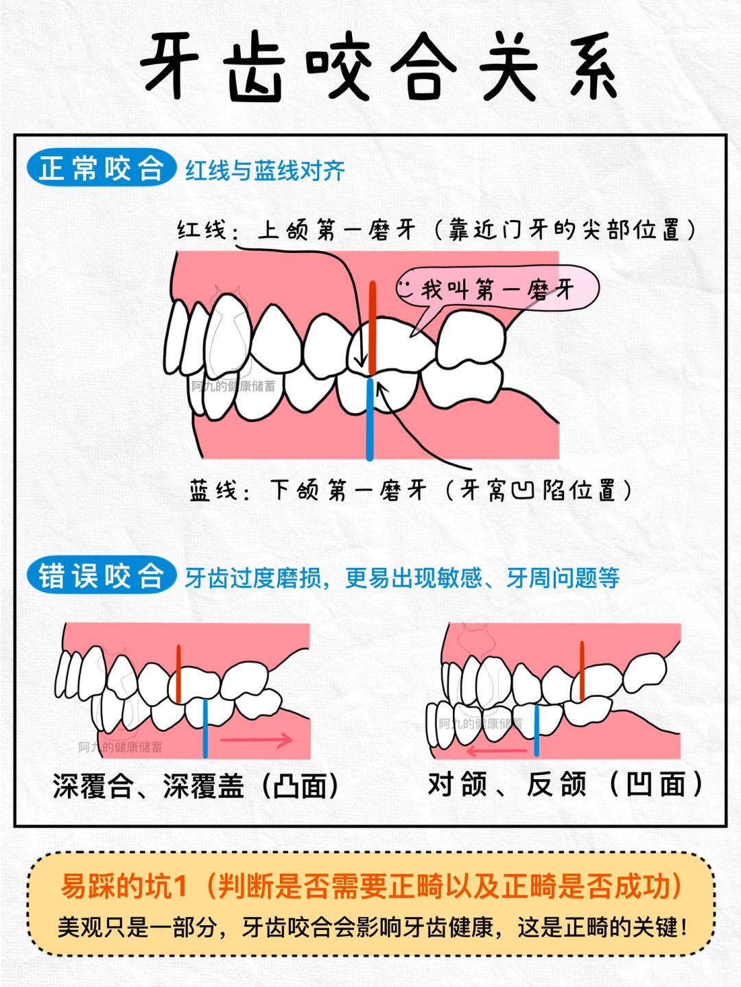 正畸一定要知道的事|避开这些“坑”‼️