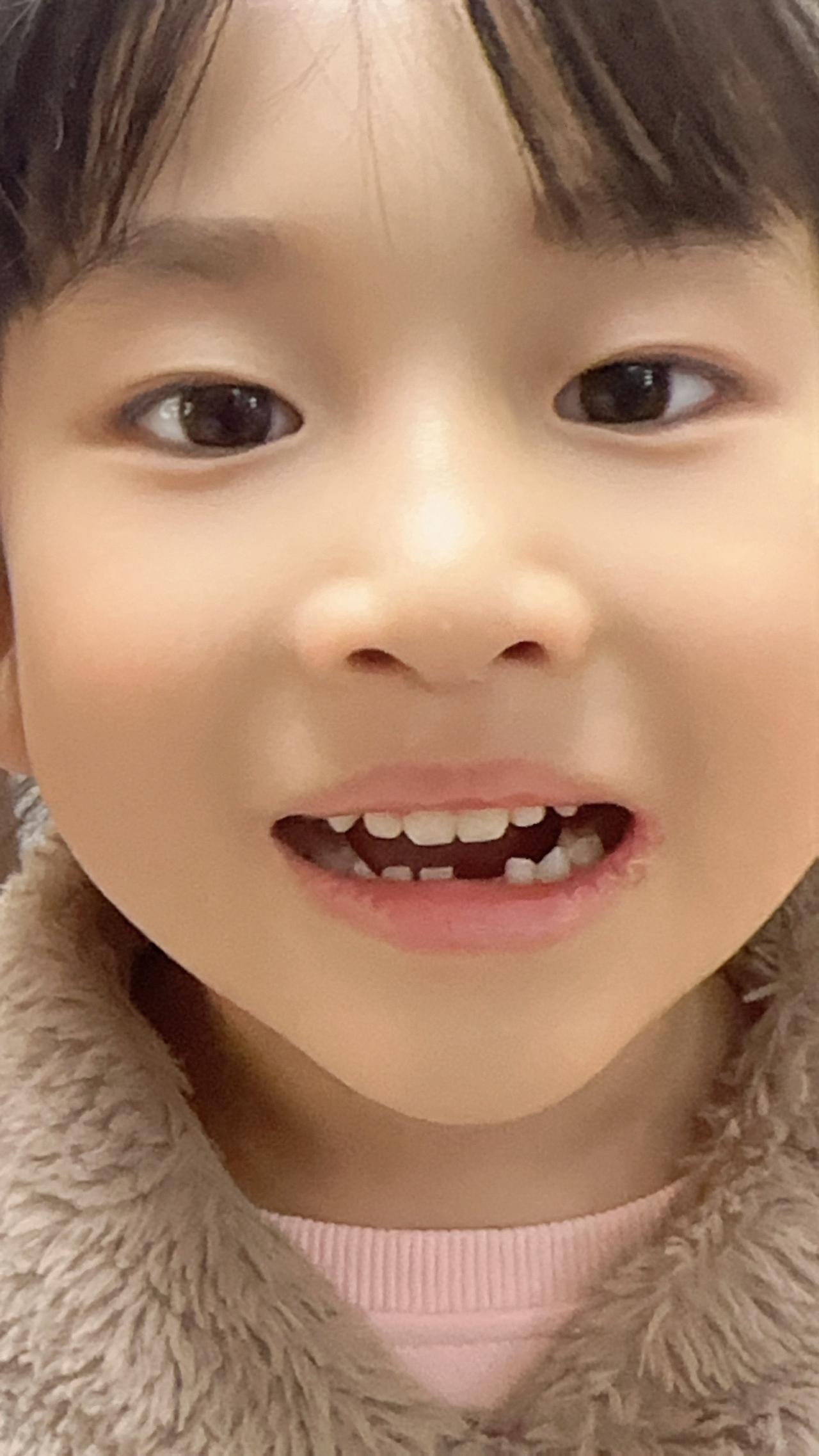 #六龄牙 早晨起床撒尿然后说牙掉了😂她说这是六龄牙