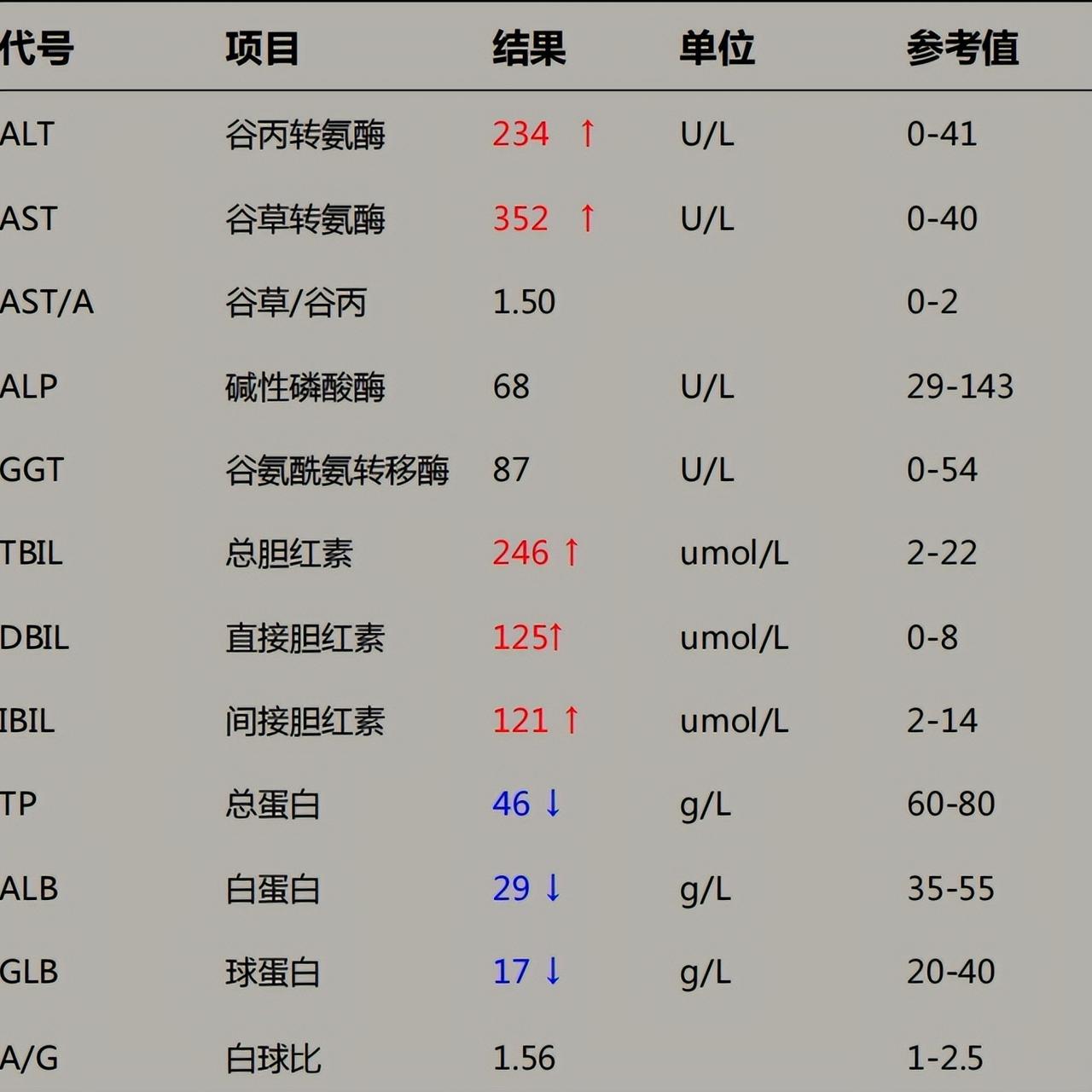 肝功能正常也可能癌变？这两项指标异常，当心肝脏出问题！
1.转氨酶升高：转氨酶是