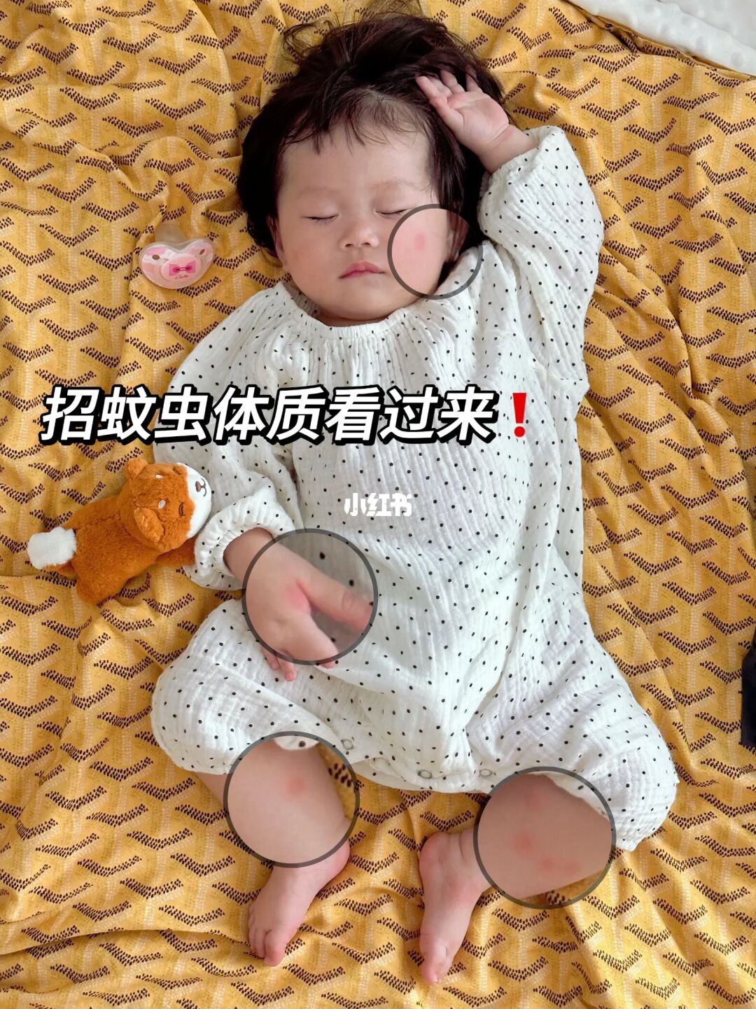 别掐十字了！被蚊子咬了瞬间止痒的方法！