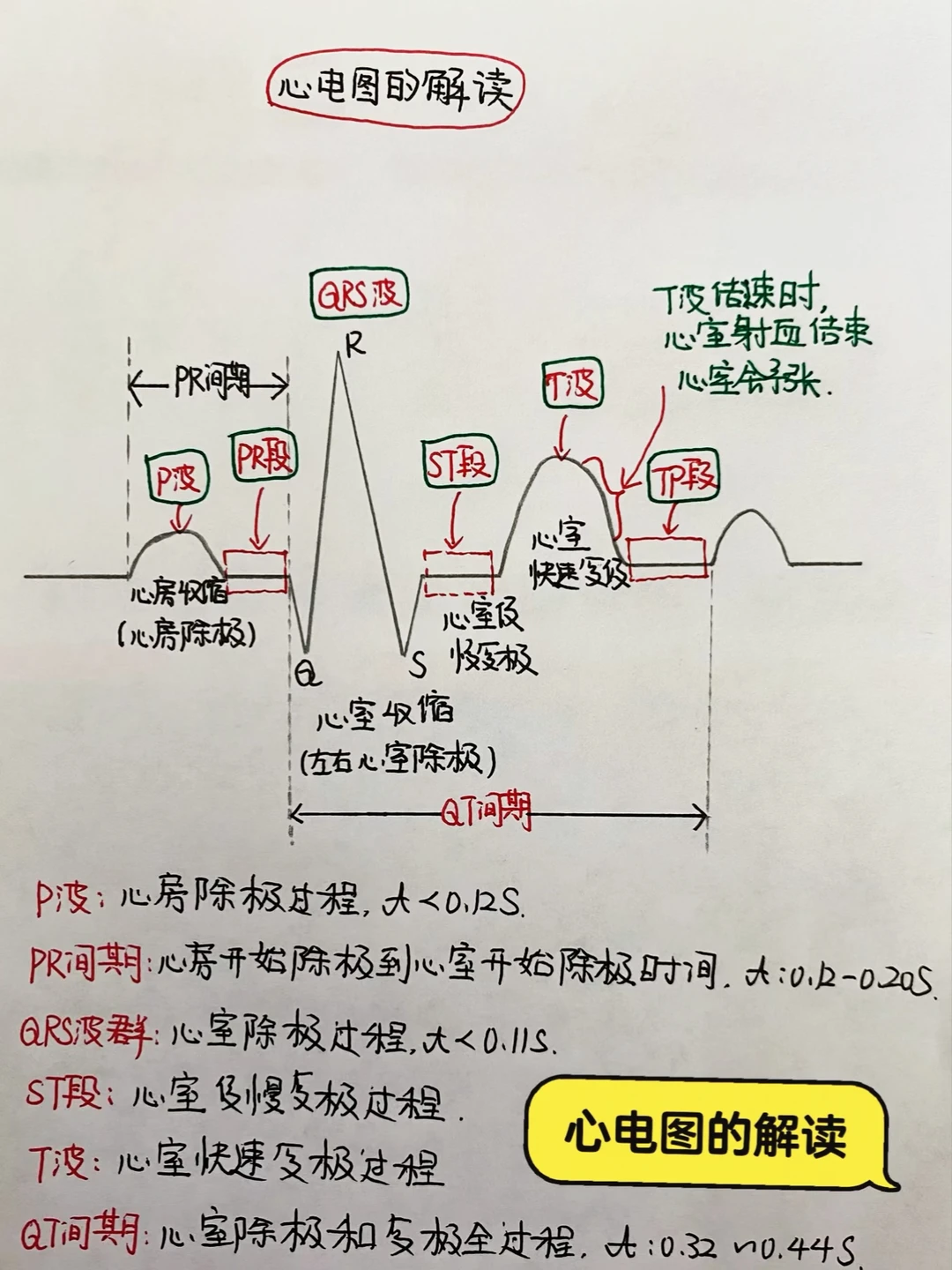 今日学习打卡——心电图的解读