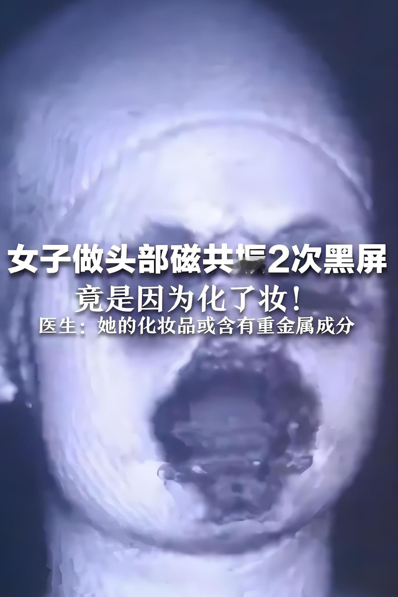 百口莫辩了，近期福建一女子，头疼到医院检查做颅内CT，影像科的影像师，幽默地向她