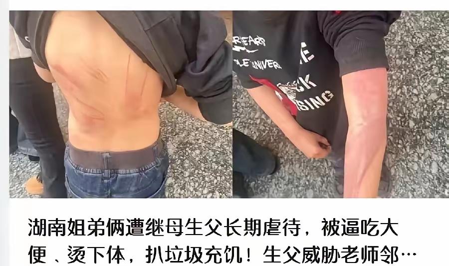 5岁儿子被70度热水烫下体，15岁女儿被簸箕砸头缝十几针，湖南这对姐弟的遭遇，真