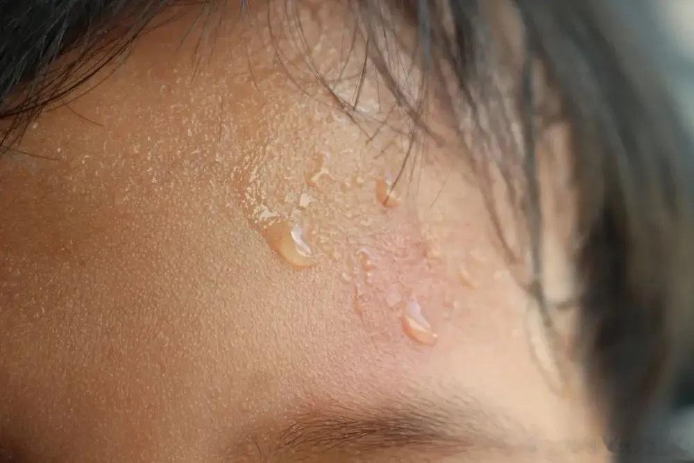 很多家长问：孩子睡觉满头大汗，是不是缺钙、体虚？其实大部分孩子是正常生理性出汗！