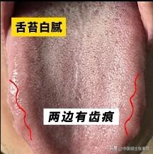 门诊大哥、35岁、敏感易泄、时间不足3分钟[吃瓜群众][吃瓜群众][吃瓜群众]

