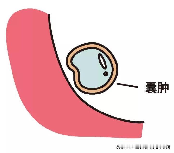 肌瘤、囊肿？就是瘀和虚，这4点不能少！
大家好，我是中医刘博纯！
气血是人体的基
