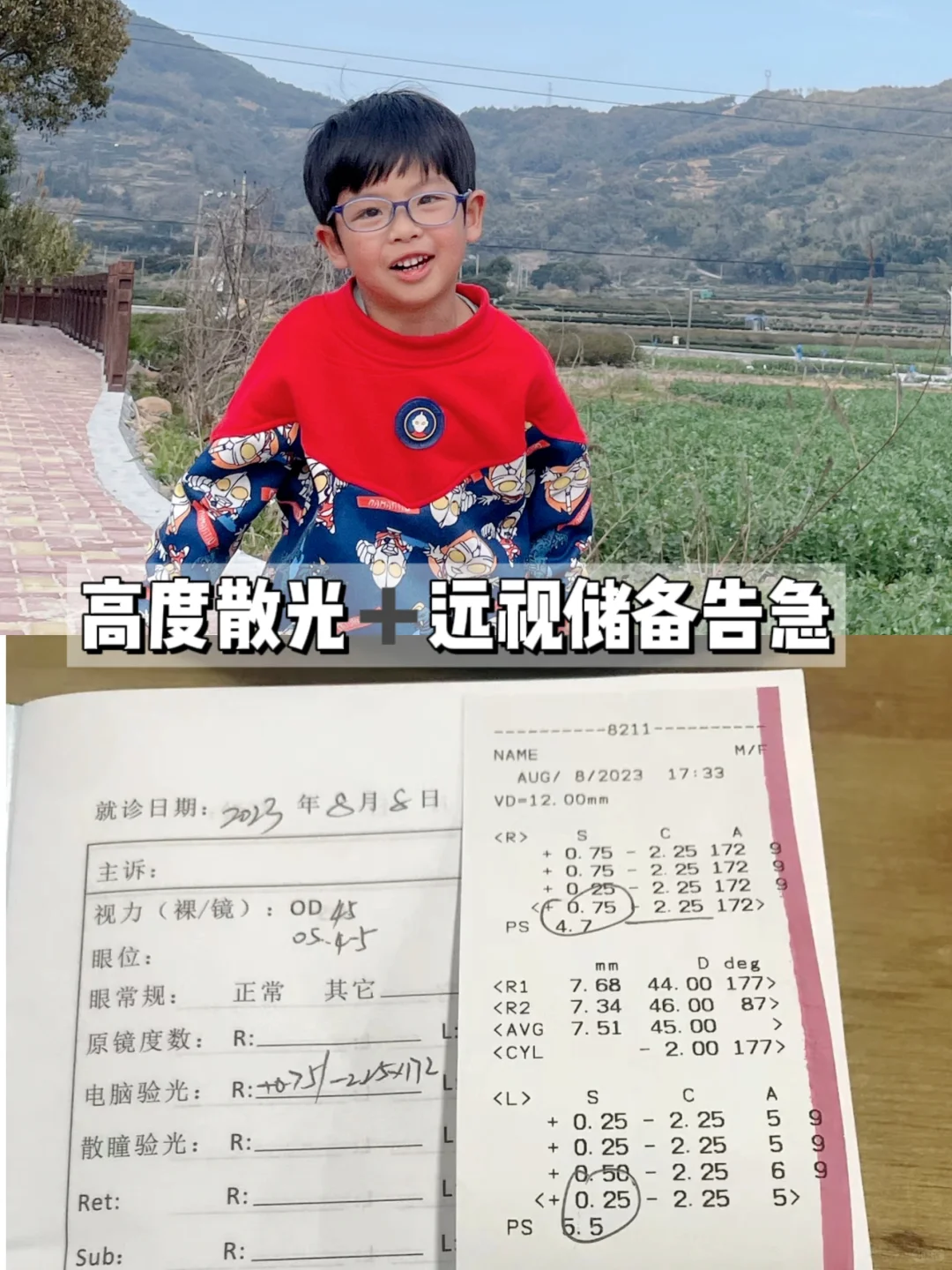 学龄期体验高度散光半年实战训练总结