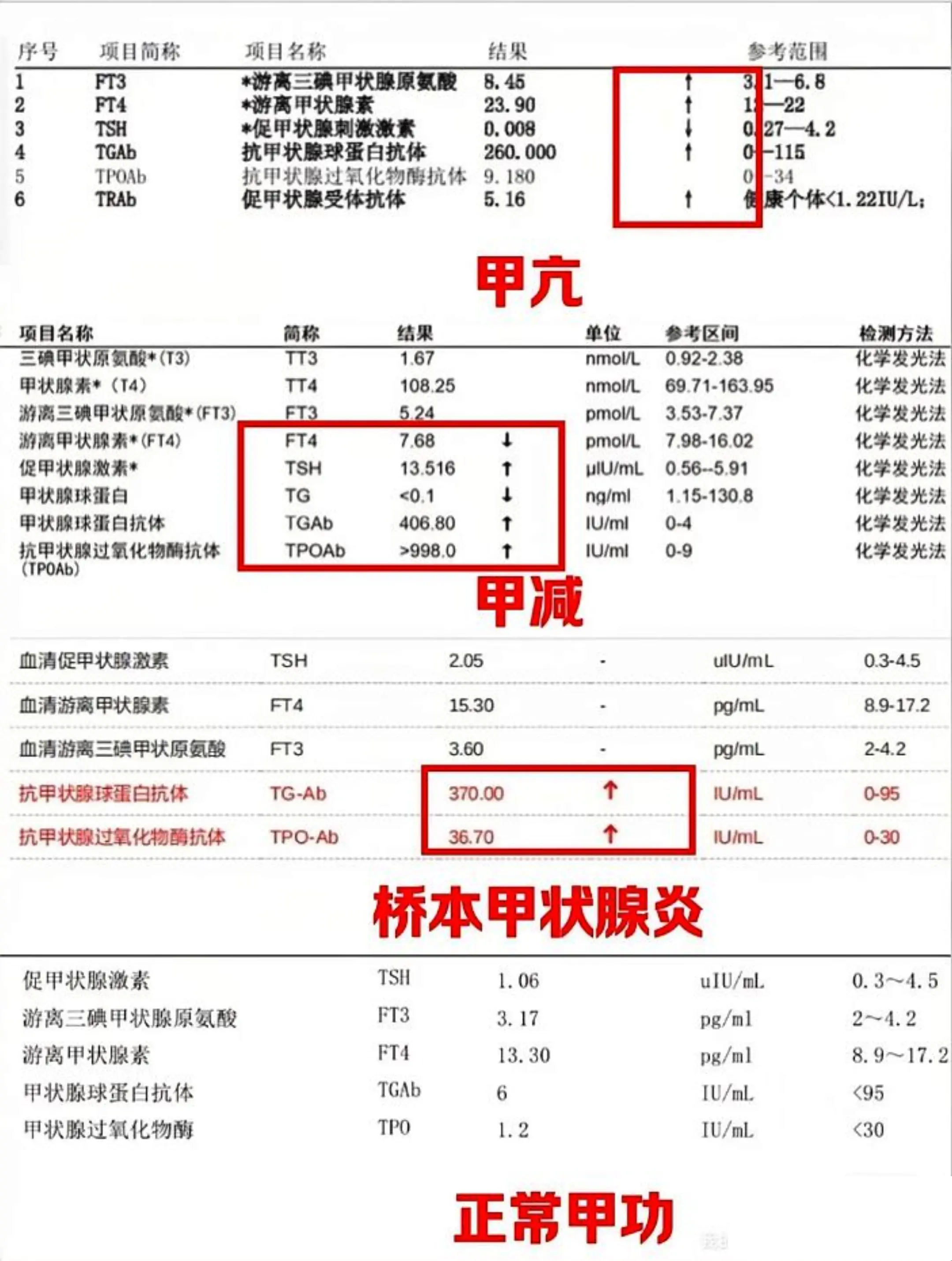 超全！一张图让你看懂甲状腺功能报告。甲状腺功能检查又被称为甲功检查，是...