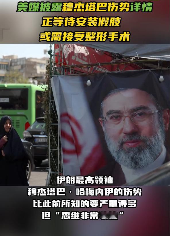 伊朗穆杰塔巴不敢露面，真相确是另有隐情，美媒把他的详细伤情披露了！

在2月28