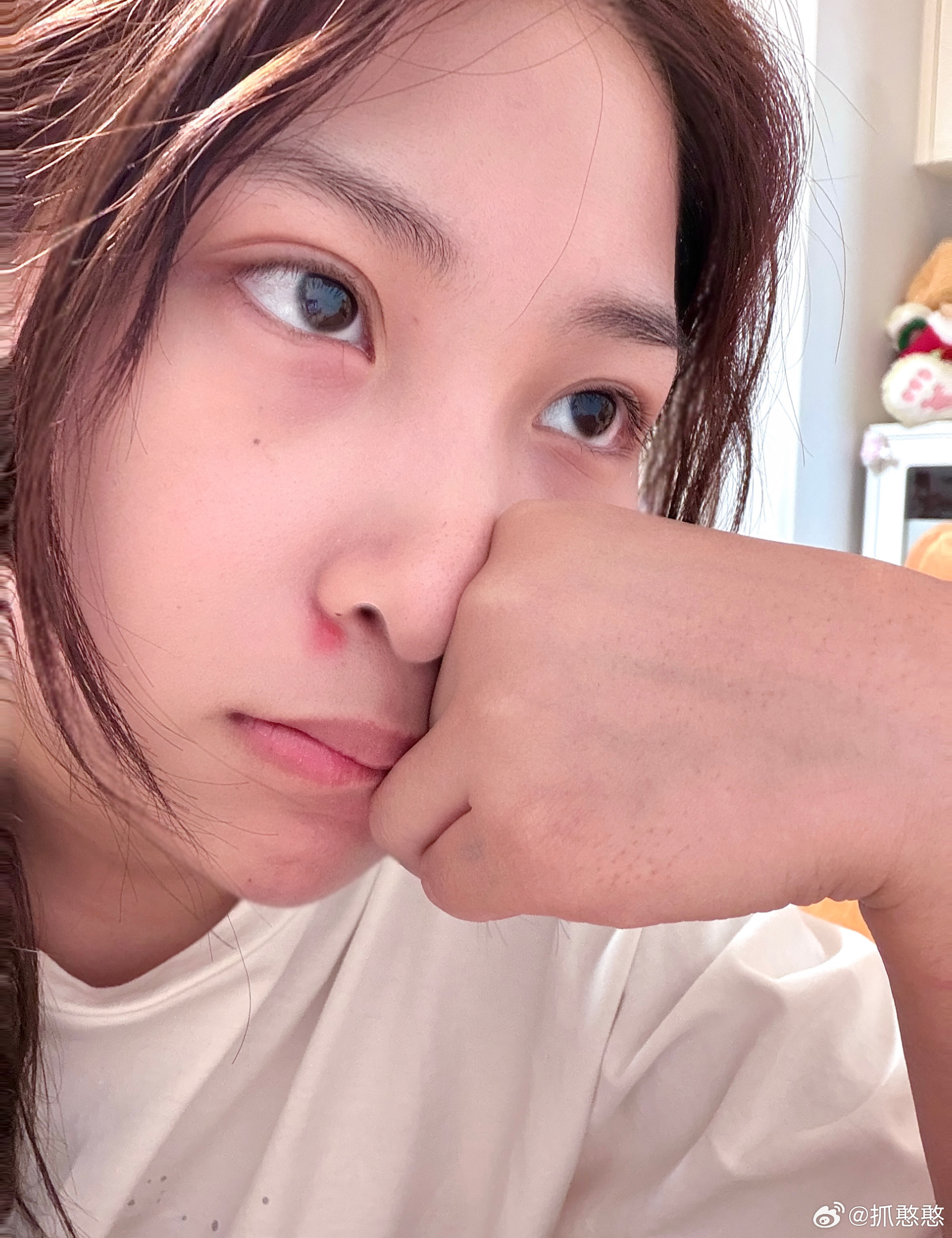 如果麦粒肿是卧蚕就好了    好疼！！闭眼就疼！！鼻子上的大痘一周了这个脸到底要