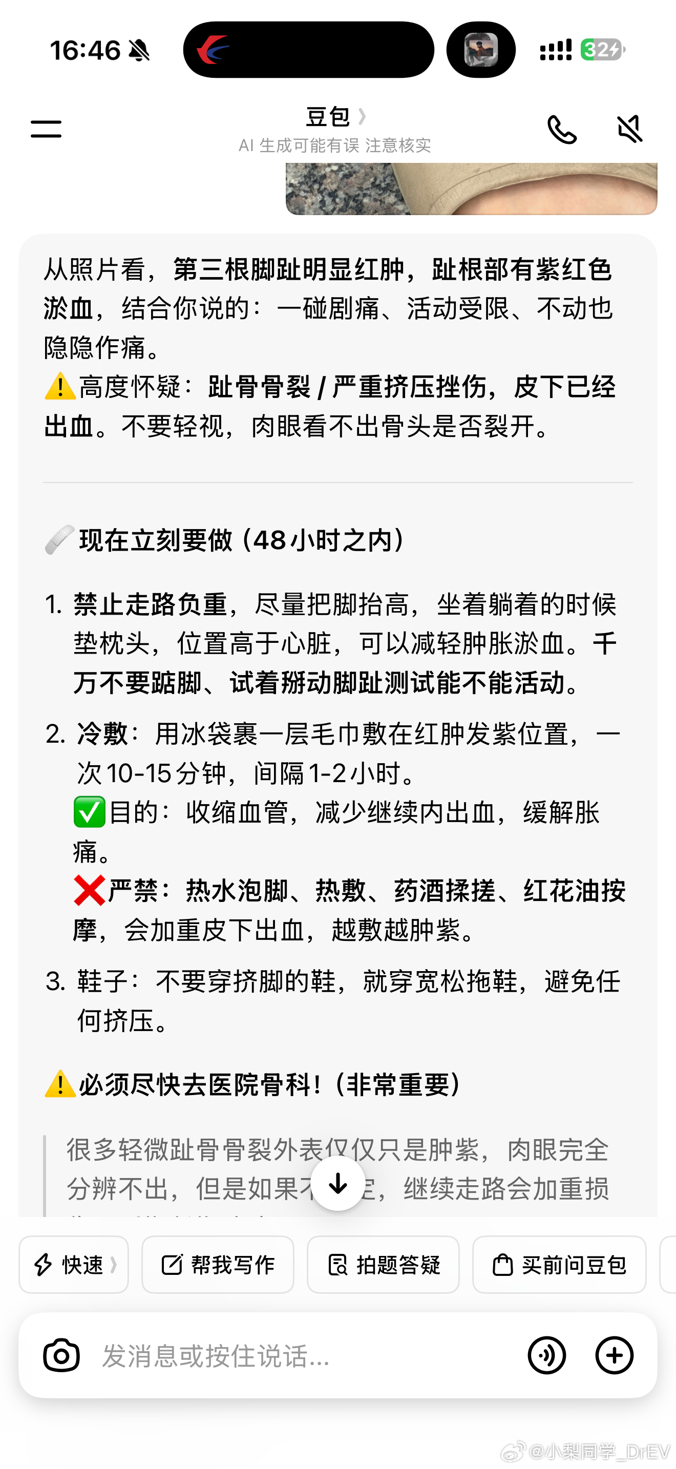 我感觉只是碰撞了一根脚趾 一问豆包就是要去医院不过确实走路一瘸一拐 还只能穿拖鞋