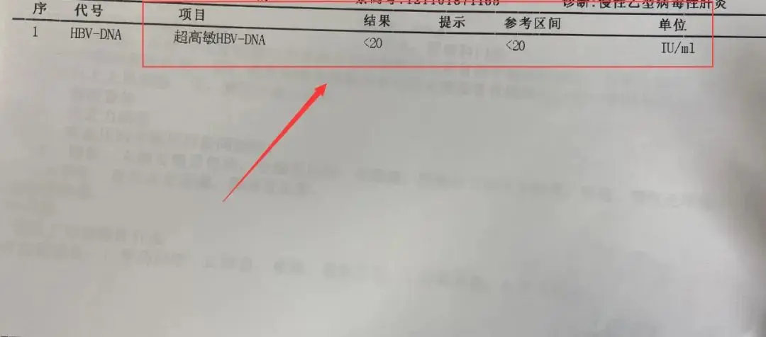 吃恩替卡韦2年以上，一定要做高敏病毒检测！ 小于500不是我们的标准...