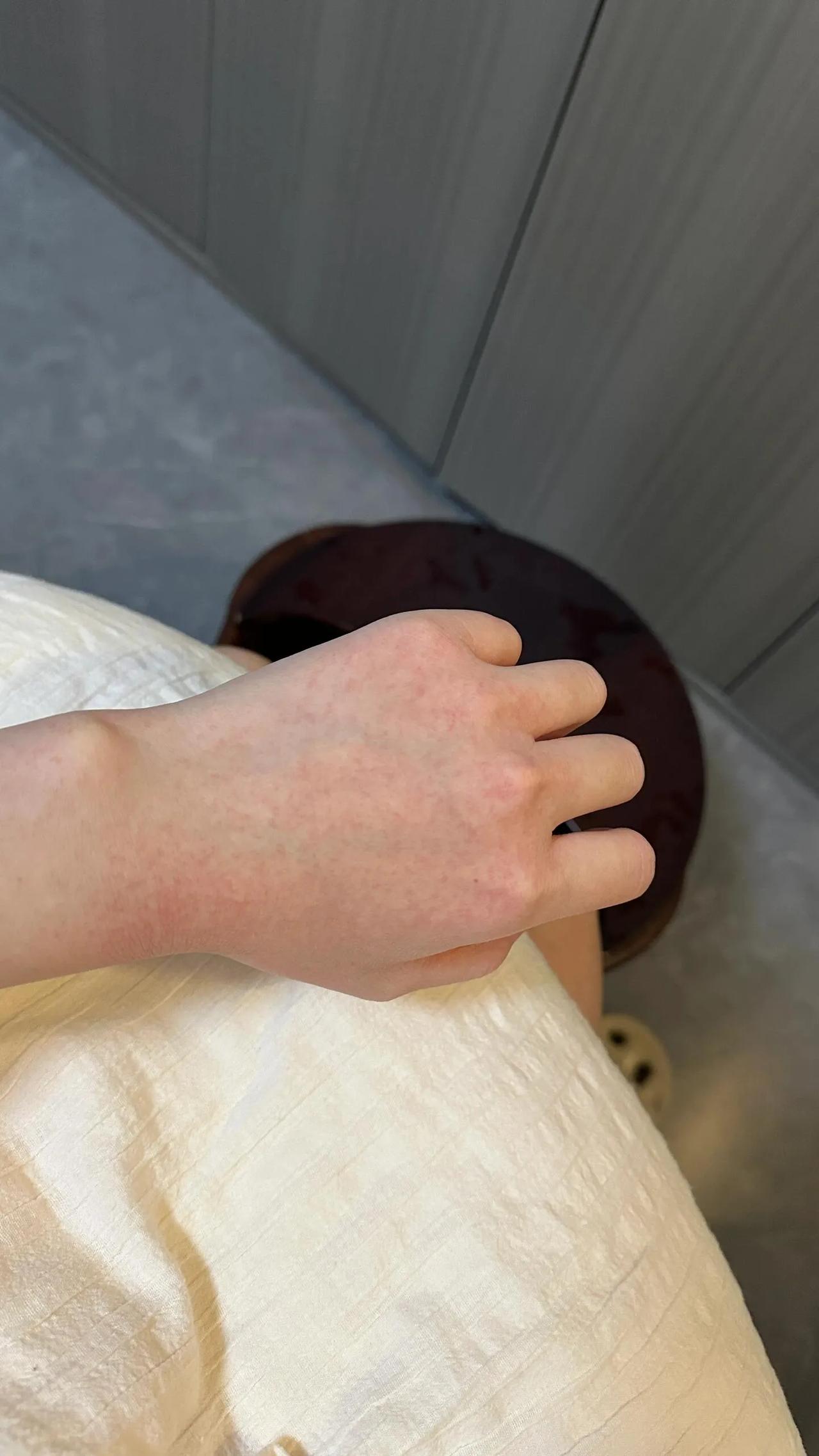 怎么戒掉洗手液
有洁癖强迫症，不喜欢别人碰我的东西，甚至连手机我一天都会用酒精棉