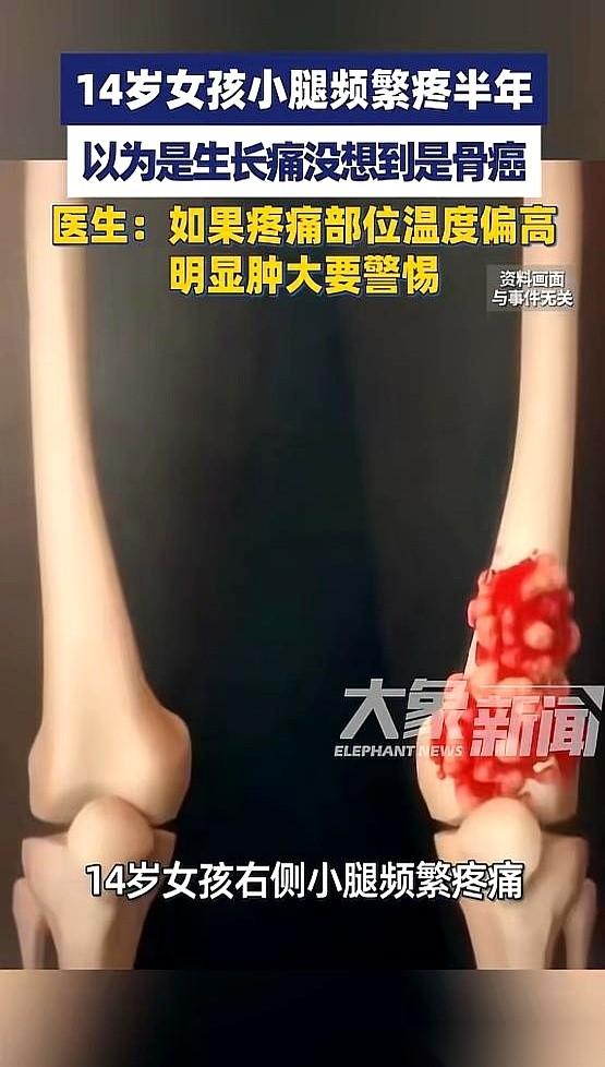 有句话，可能毁掉一个孩子，而我们几乎天天都在说：“没事，就是长个子的生长痛。”