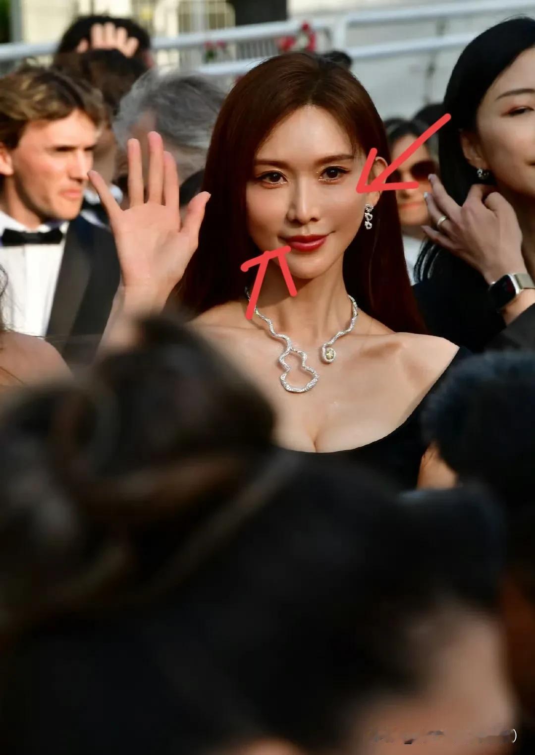 没人发现林志玲的脸这么crazy吗？

正常女人到了她这个年纪，脸部基本上都会下
