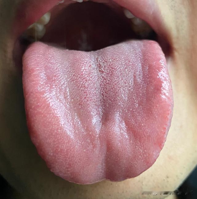 门诊小伙才20多岁，看着跟没睡醒一样，迷迷糊糊的[吃瓜群众][吃瓜群众][吃瓜群