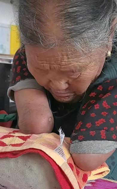 生来四肢全无，嫁给了全村最穷的汉子，81岁高龄的她，却笑着面对镜头坦言：“我很幸