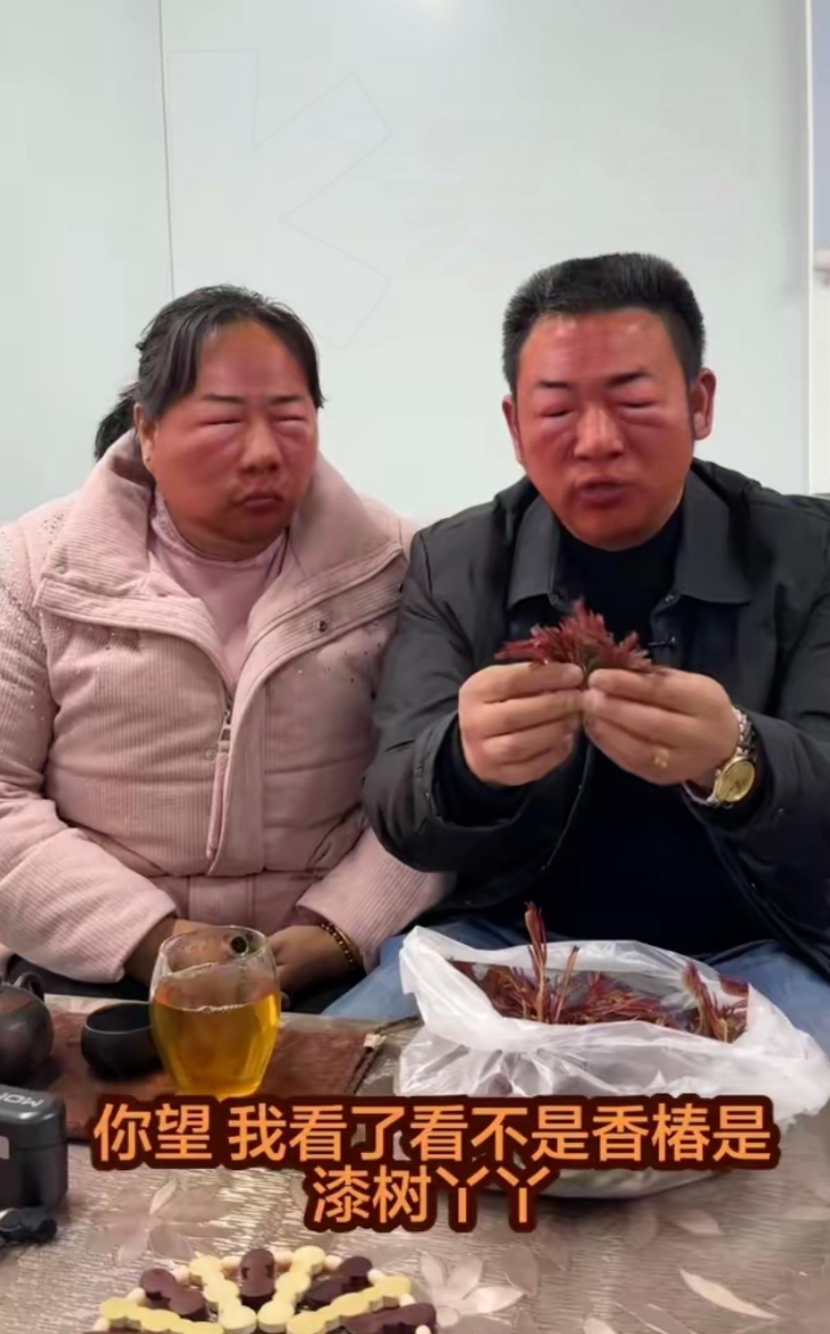 笑不活又心疼！把漆树芽当香椿吃，夫妻俩直接肿到认不出，连打码都省了。
 
   