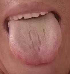 功能偏弱、控制力不足？很多根源在于肝脏失调，疏肝养血才是调理重点。





