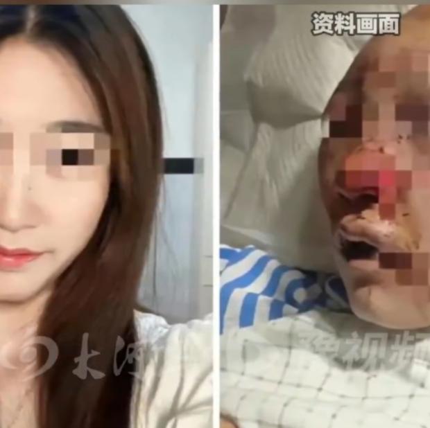 谁也不会想到，一次再普通不过的出门，仅仅是去村里上一趟公厕，竟然会变成一场挥之不