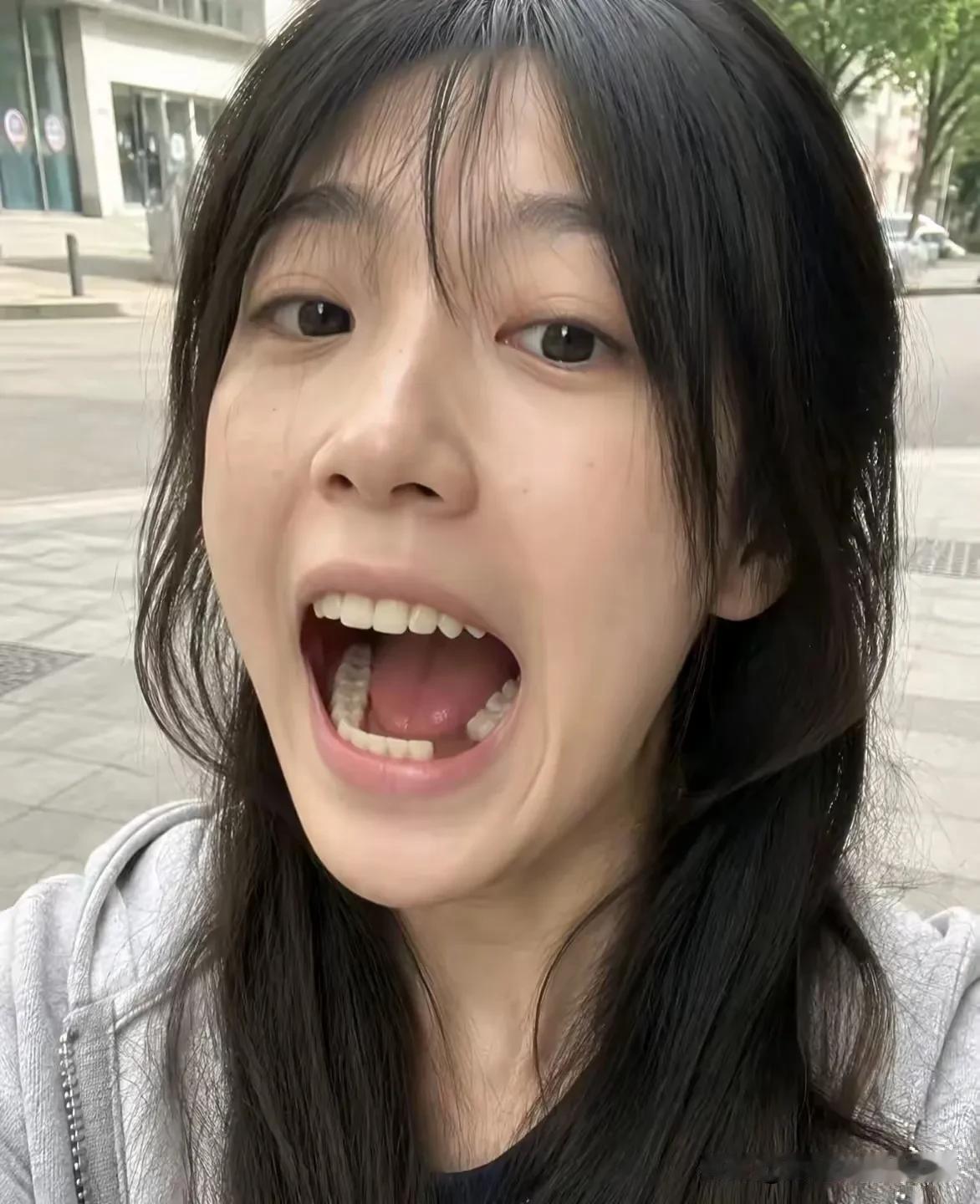 这个位置缺了一颗牙，对她最大的影响是什么？