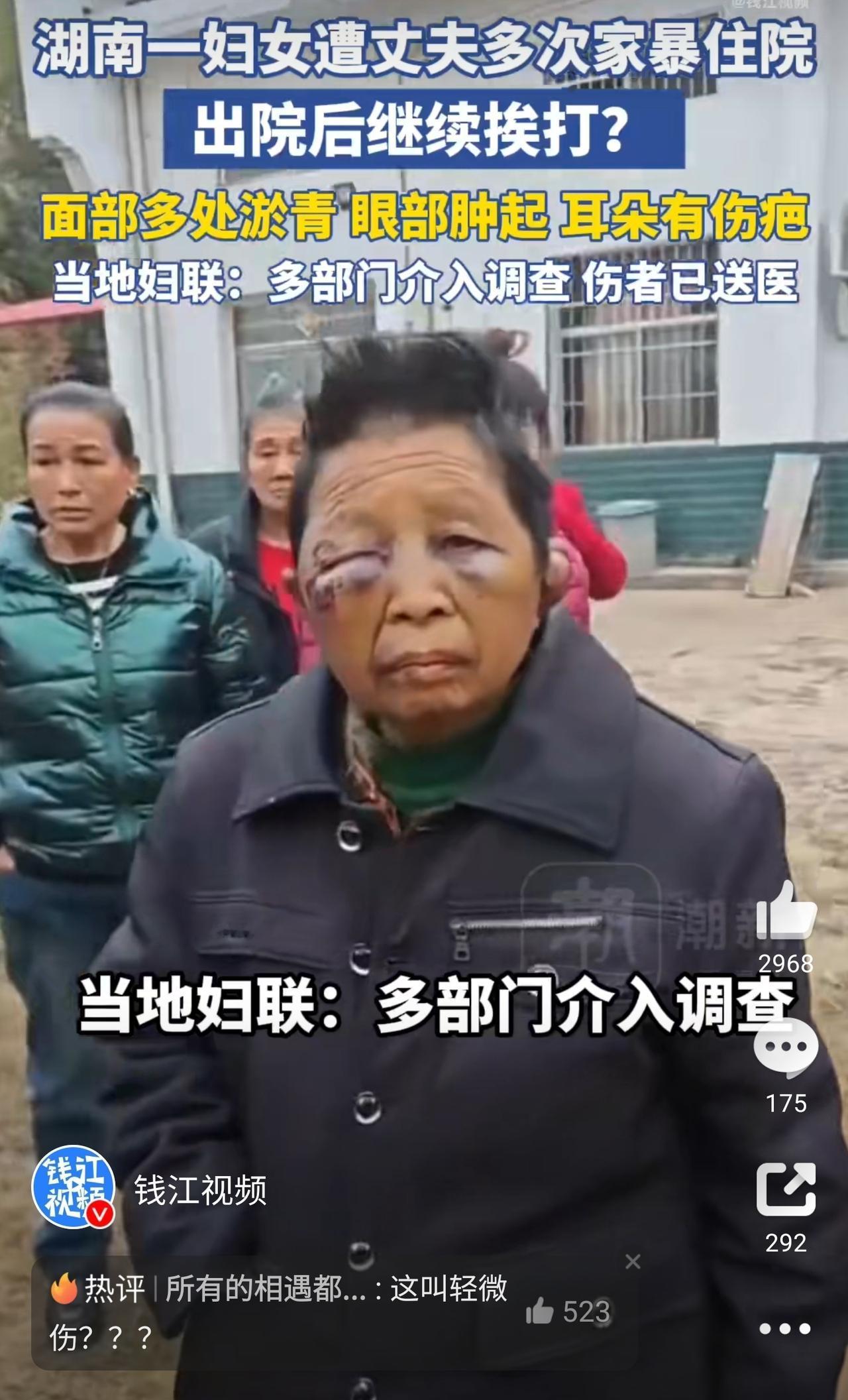 太雷人了！71岁老人被丈夫打得脸肿耳裂，却只被定成“轻微伤”。

在湖南平江一个