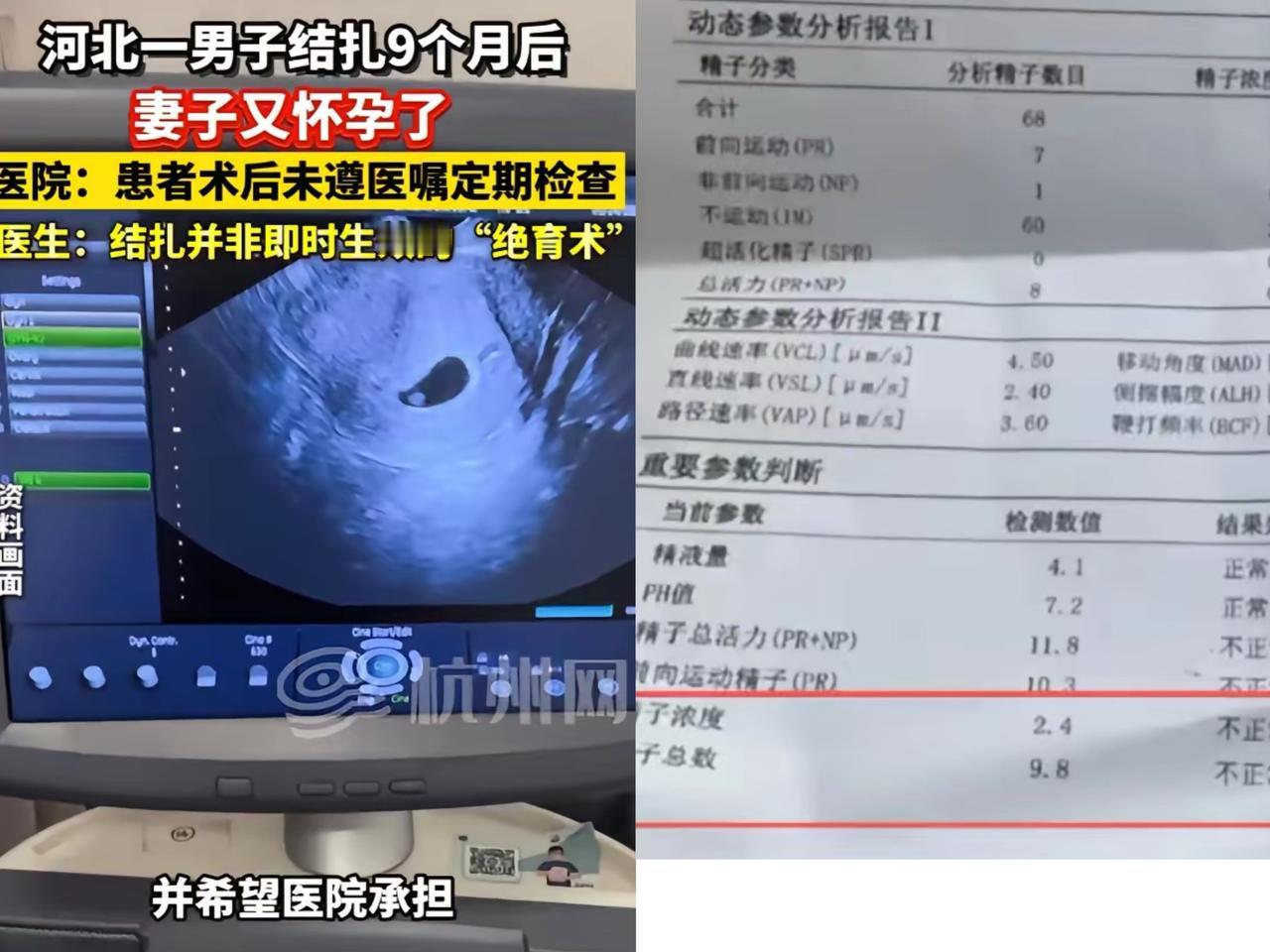 “离了个大谱！”
河北这事儿可真让人惊掉下巴。
一女子

月经迟迟不来，去医院一