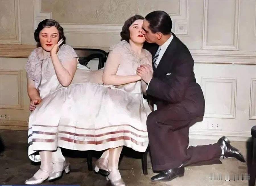 这张照片展示的是 1912 年出生于美国的连体双胞胎玛格丽特·吉布（Margar