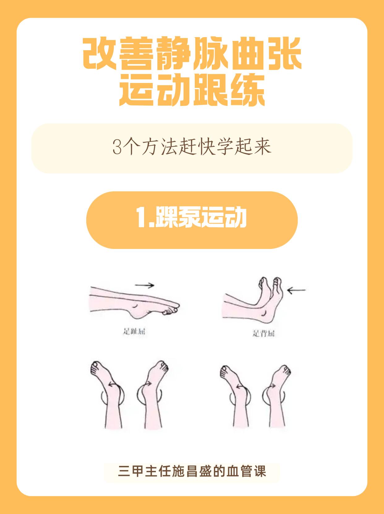 改善静脉曲张运动跟练。想改善静脉曲张？简单三步，轻松跟练，助你缓解静脉曲张不适！