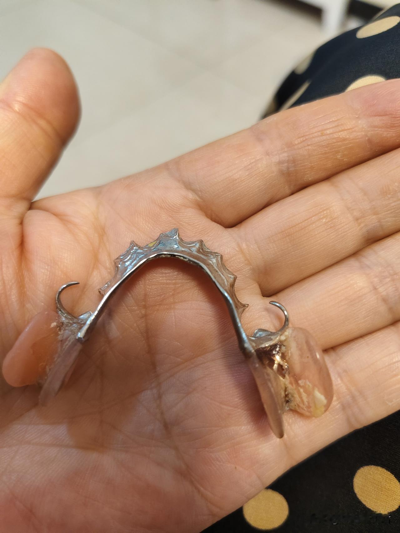你的义齿是在哪里做的呀，摆摊的牙医你们认可吗？
我牙齿状况不太好，那时候，感冒嗓