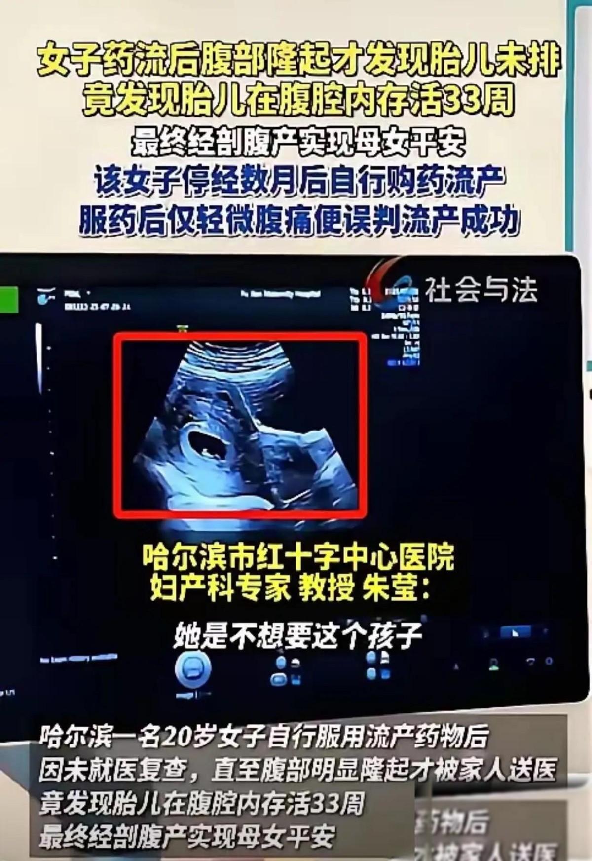 哈尔滨一个20岁的姑娘，吃药想把孩子打掉。结果B超探头一放上去，连大夫都惊出一身