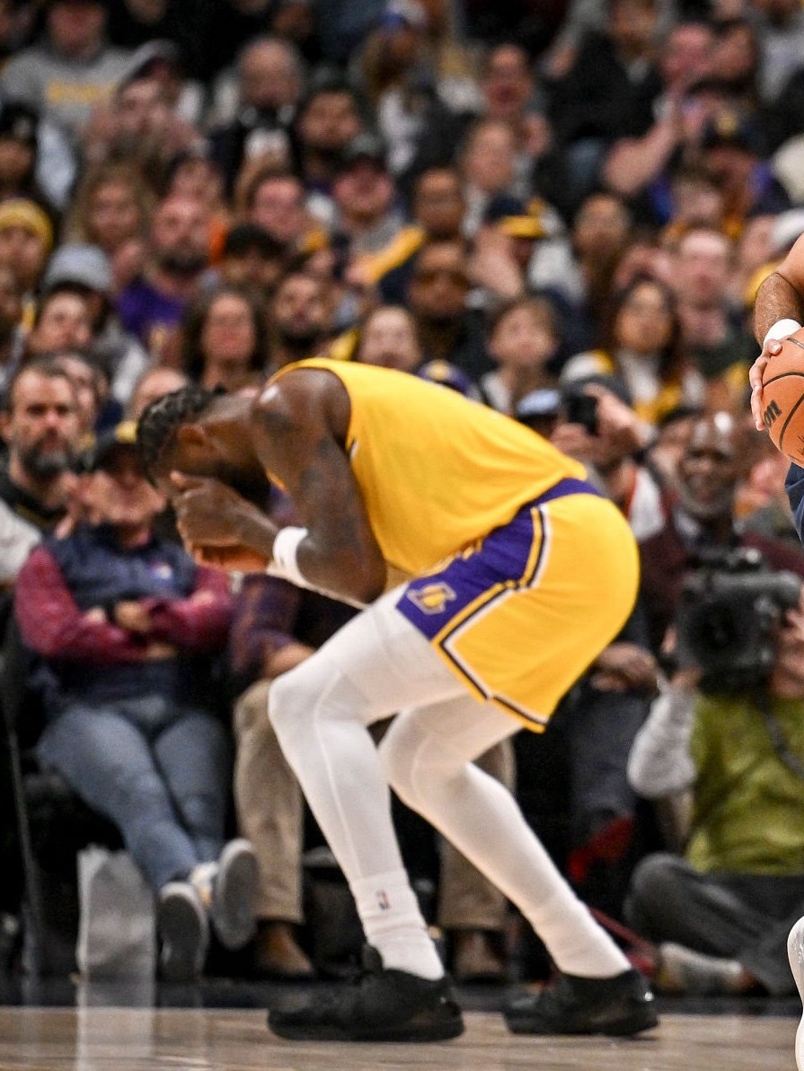 雷迪克说，艾顿被戳到眼睛后看起来像个海盗，但愿他伤势不重，明天就能恢复正常。湖人