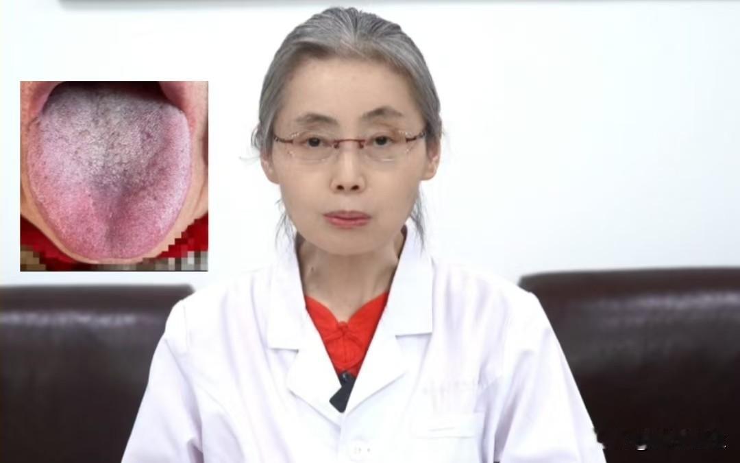 肝气不疏，只知一味祛湿，难怪越来越严重

前段时间，来了一名体型稍微偏胖的患者，