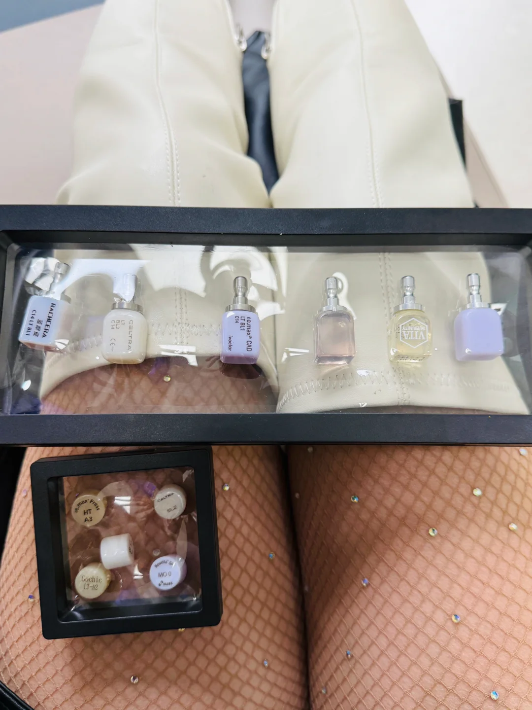 OOTD｜分享一下我的贴面过程~北京牙齿贴面
