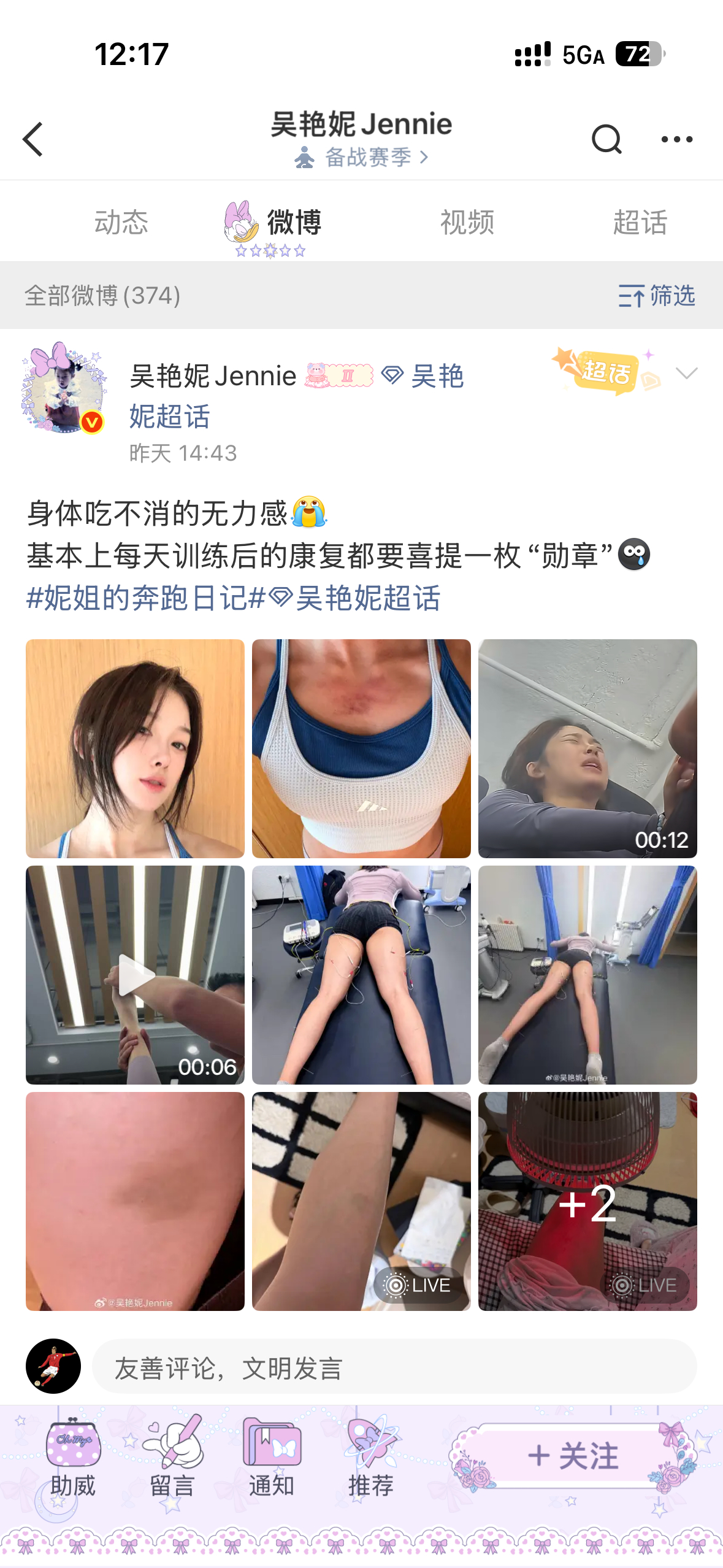 吴艳妮腿上好多淤青拔罐和刮痧留下的痕迹。应该不影响什么的。 