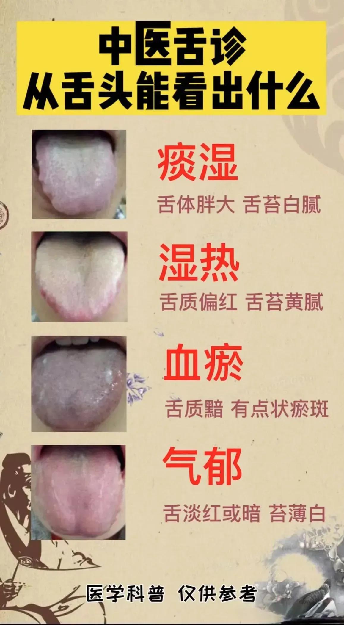 舌诊是中医诊断的重要手段之一，通过观察舌苔和舌质的变化，可以了解身体的健康状况。