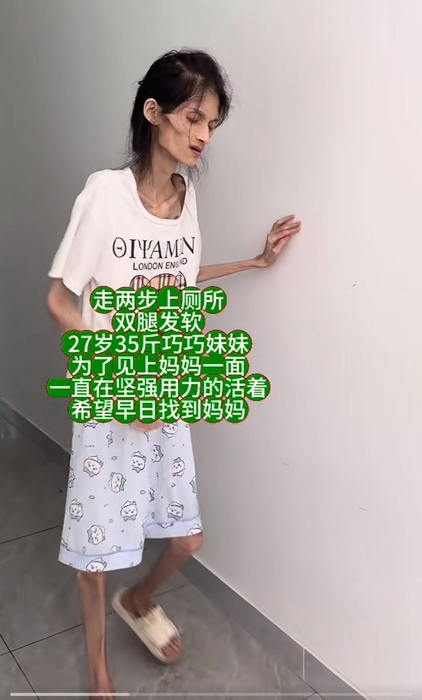 巧巧有好心人帮助了，给她洗头，扶她起来，可以托墙行走，35斤能走也算个奇迹。她现