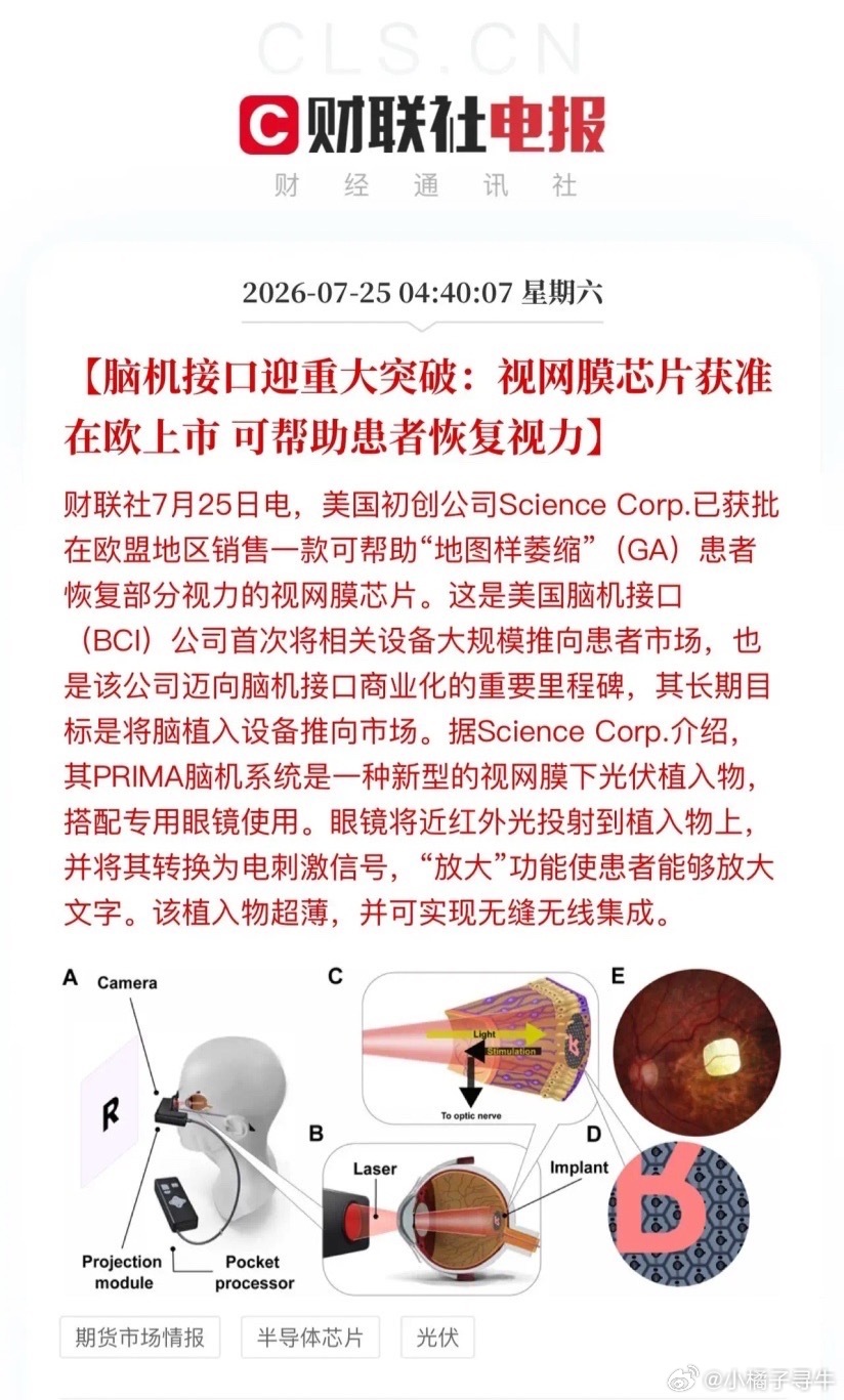 脑机接口应用这下真的照进现实了！中美脑机前沿研究均不断取得突破：脑机信号是交换机