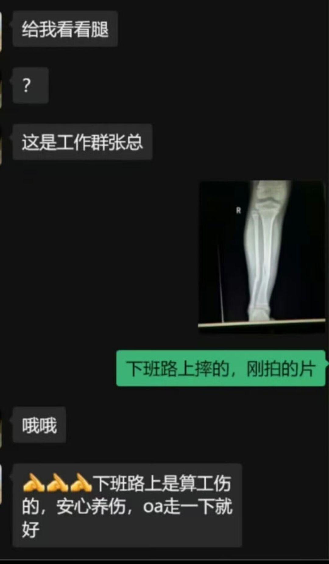 小伙手滑在工作大群误给张总发消息：给我看看腿，消息发出瞬间后背发凉，眼看社死现场