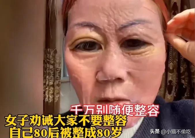 这是整容吗？简直就是毁容！
80后女子整容失败，在社交媒体上告诫后来者：“千万不
